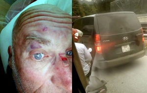 Du khách nước ngoài bị 4-5 thanh niên đánh trên đường lên Sa Pa