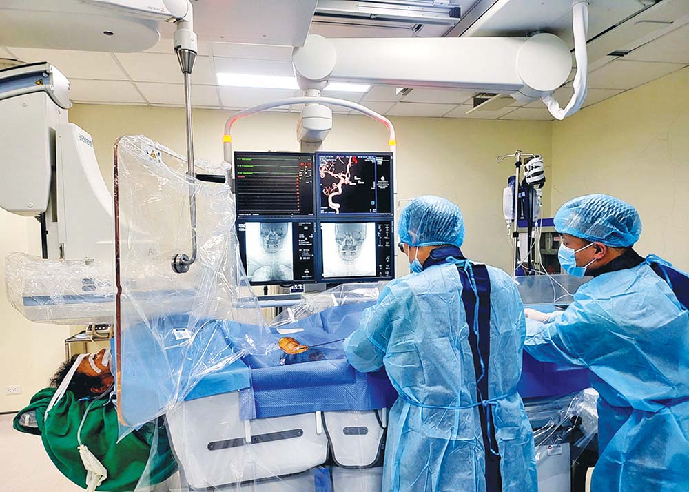 Bệnh viện Đa khoa tỉnh Hà Giang cấp cứu can thiệp thành công một ca bệnh vỡ phình động mạch não