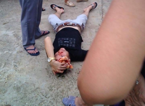 Nam thanh niên bị thương sau khi có hành vi chống đối người thi hành công vụ ở Tuyên Quang