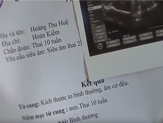 Sự thiếu logic xuất hiện ở họ tên của nhân vật Huệ do diễn viên Thu Quỳnh thủ vai. Ở tập 6, Huệ có tin vui khi mang thai đầu lòng với Khải (Trọng Hùng). Trên tờ phiếu siêu âm, tên cô được viết là Hoàng Thu Huệ.