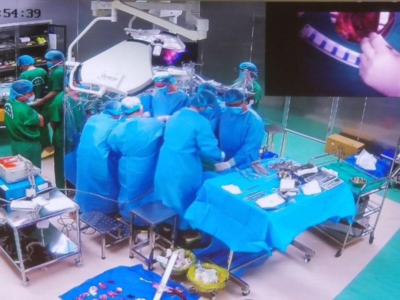 Hình ảnh ca chuyển giao phẫu thuật mổ tim đầu tiên tại bệnh viện đa khoa tỉnh Thái Bình.
