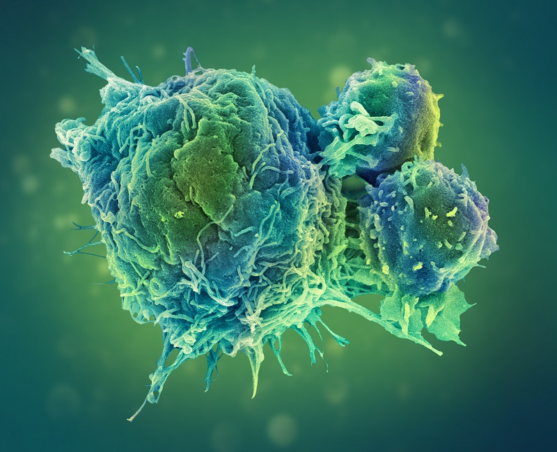 Liệu pháp miễn dịch ung thư giúp tăng sức mạnh để chống lại các tế bào ung thư một cách có chọn lọc.