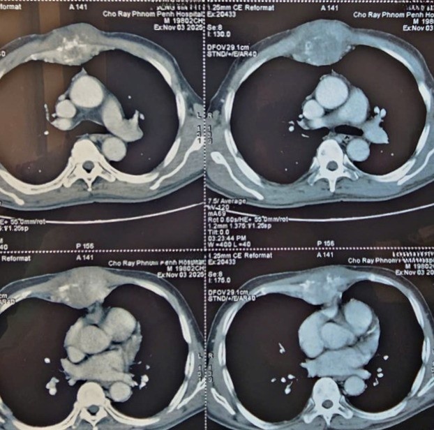 image_1775647728105.jpg image_1775647728105.jpg