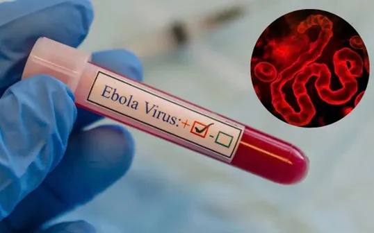 ebola-23158248065712023426944-14532308134710112542392.jpg