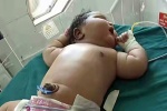 Bà mẹ Ấn Độ sinh con nặng gấp đôi trọng lượng bé sơ sinh bình thường