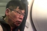 United Airlines bồi thường khủng cho bác sĩ gốc Việt David Dao