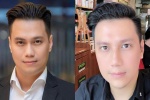 Diễn viên Việt Anh: 'Tôi vẫn men 100% sau phẫu thuật thẩm mỹ'