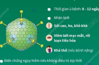 Nhận biết trẻ em mắc virus Adeno và cách phòng tránh