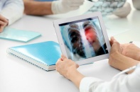 Cảnh báo mức độ nguy hiểm của bệnh nấm phổi