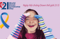 Ngày Hội chứng Down thế giới 21/3: Những điều cần biết