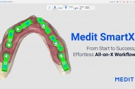 Medit giới thiệu quy trình làm việc Medit All-on-X