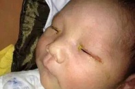  Giáo sư Đỗ Như Hơn phản bác tin "mù mắt vì chụp ảnh có đèn flash"
