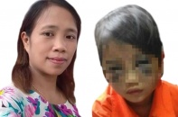 Lào Cai: Cô giáo đánh bầm mặt nữ học sinh lớp 1 