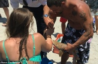 Hy hữu cô gái tắm biển bị cá mập cắn tay tới tận lúc vào bệnh viện