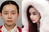 Cô gái chi 100 triệu Nhân dân tệ để phẫu thuật giống Angelababy