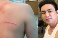 Vợ cũ của bác sĩ Chiêm Quốc Thái bị bắt khẩn cấp vì thuê người truy sát chồng