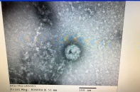 Việt Nam nuôi cấy, phân lập thành công virus Corona mới 