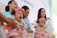 Thành phố Hồ Chí Minh: Cặp song sinh Trúc Nhi-Diệu Nhi xuất viện