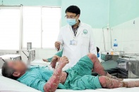 Vấn nạn ngộ độc thuốc nam không rõ nguồn gốc