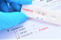 Cấp mã số ca bệnh cho người có kết quả dương tính qua test nhanh thế nào