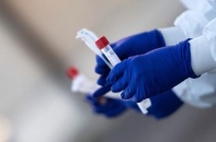 Vì sao lại có nhiều mức giá test nhanh Covid-19?