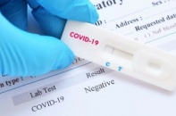 Tin mới về Covid-19 ngày 13/12: Bộ Y tế nói gì về công nhận bệnh nhân khỏi bệnh qua test nhanh?