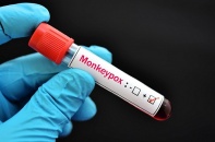 Tin mới về y tế ngày 30/7: Không chủ quan bệnh đậu mùa khỉ, châu Âu, Nam Mỹ đã có những ca tử vong đầu tiên