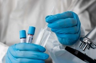 Số ca Covid-19 tăng kỷ lục trong 3 tháng qua