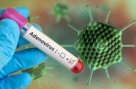 Tin mới về y tế ngày 30/9: Tăng cường giám sát và phòng chống bệnh do Adenovirus; Thu hồi triệt để thuốc không đạt chất lượng