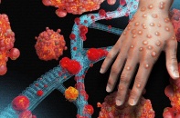 Tin mới về y tế ngày 4/10: Các biện pháp phòng bệnh đậu mùa khỉ; Phân luồng, tuyến điều trị bệnh nhân mắc Adenovirus