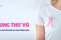 Trên 70% ca ung thư vú được phát hiện và điều trị sớm