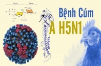 Tin mới về y tế ngày 26/2: TP.HCM chỉ đạo giám sát chặt các cửa khẩu chống dịch cúm