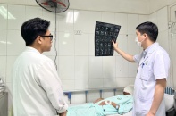 Can thiệp cho bệnh nhân có khối u khổng lồ vùng mặt 