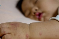 Nỗi lo “dịch chồng dịch” tại TP.HCM