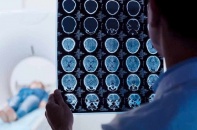 Tin mới y tế ngày 9/7: Các dấu hiệu cảnh báo mắc u não Schwannoma