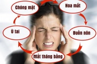 Nhiều người trẻ mắc rối loạn tiền đình