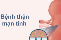 Tin mới y tế ngày 14/11: Đề xuất thêm một số bệnh vào Chiến lược quốc gia bệnh không lây nhiễm