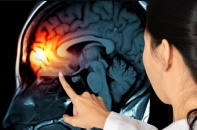 Tưởng trầm cảm sau sinh, đi khám phát hiện u não