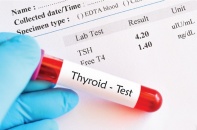 Trẻ 9 tuổi mắc suy giáp do viêm tuyến giáp mạn tính Trẻ 9 tuổi mắc suy giáp do viêm tuyến giáp mạn tính