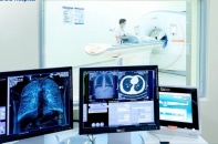 Hút thuốc hàng chục năm, nhiều người phát hiện ung thư phổi khi đã muộn