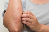 Tin mới y tế ngày 2/11: Khỏi bệnh da di truyền hiếm gặp nhờ kỹ thuật mới