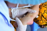 Dịch tay chân miệng gia tăng bất thường, nhiều trẻ biến chứng nặng