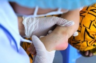 Sở Y tế TP.HCM cảnh báo tác nhân EV71 xuất hiện trở lại