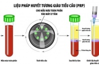 Chủ quan với chấn thương nhẹ, nguy cơ tổn thương gân kéo dài