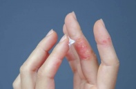 Tin mới y tế ngày 19/1: Ứng dụng AI chẩn đoán ung thư phổi sớm