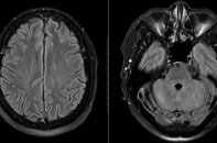 Cảnh báo hệ lụy từ món ăn “quen thuộc” ngày Tết