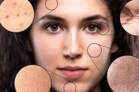 Tin mới y tế ngày 5/2: Cảnh báo dấu hiệu ung thư da không thể bỏ qua