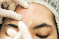 Làm đẹp “cấp tốc” đón Tết, tai biến không còn là chuyện hiếm