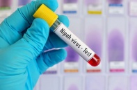 Bộ Y tế siết giám sát dịch bệnh dịp Tết Bính Ngọ 2026, chủ động ứng phó nguy cơ virus Nipah