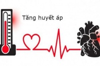 Tin mới y tế ngày 1/4: Chủ quan với tăng huyết áp, người phụ nữ 62 tuổi bị xuất huyết não